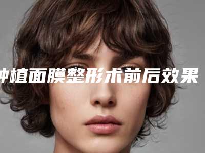 张家口市鼻梁垫高医院在榜名单专家值得推荐-张家口天宏美容服务有限公司揭晓实力高低