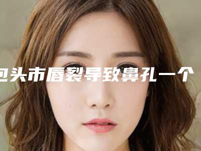 包头市唇裂导致鼻孔一个大一个小医院整形-包头稀土高新区稀土路街道办事处高新花园社区卫生服务中心人气口碑实力相当~