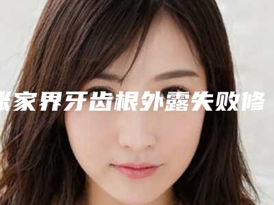 张家界牙齿根外露失败修复适合那些人群
