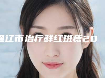 通辽市治疗鲜红斑痣2025价格(费用)在线咨询(近6个月均价为:5255元)